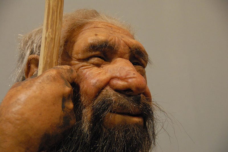 Neanderthal fossil illustrating ancient ailments