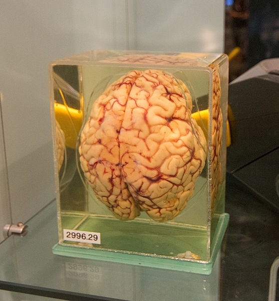 Human brain preserved in formaldehyde